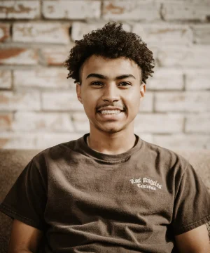 Smile transformation 5